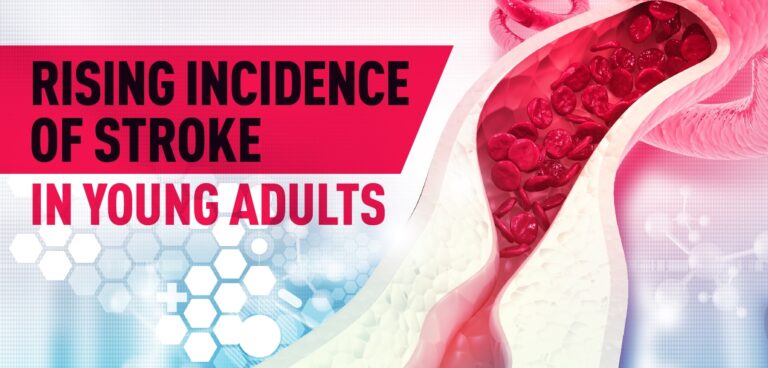 Rising Incidence Of Stroke In Young Adults 011321 01